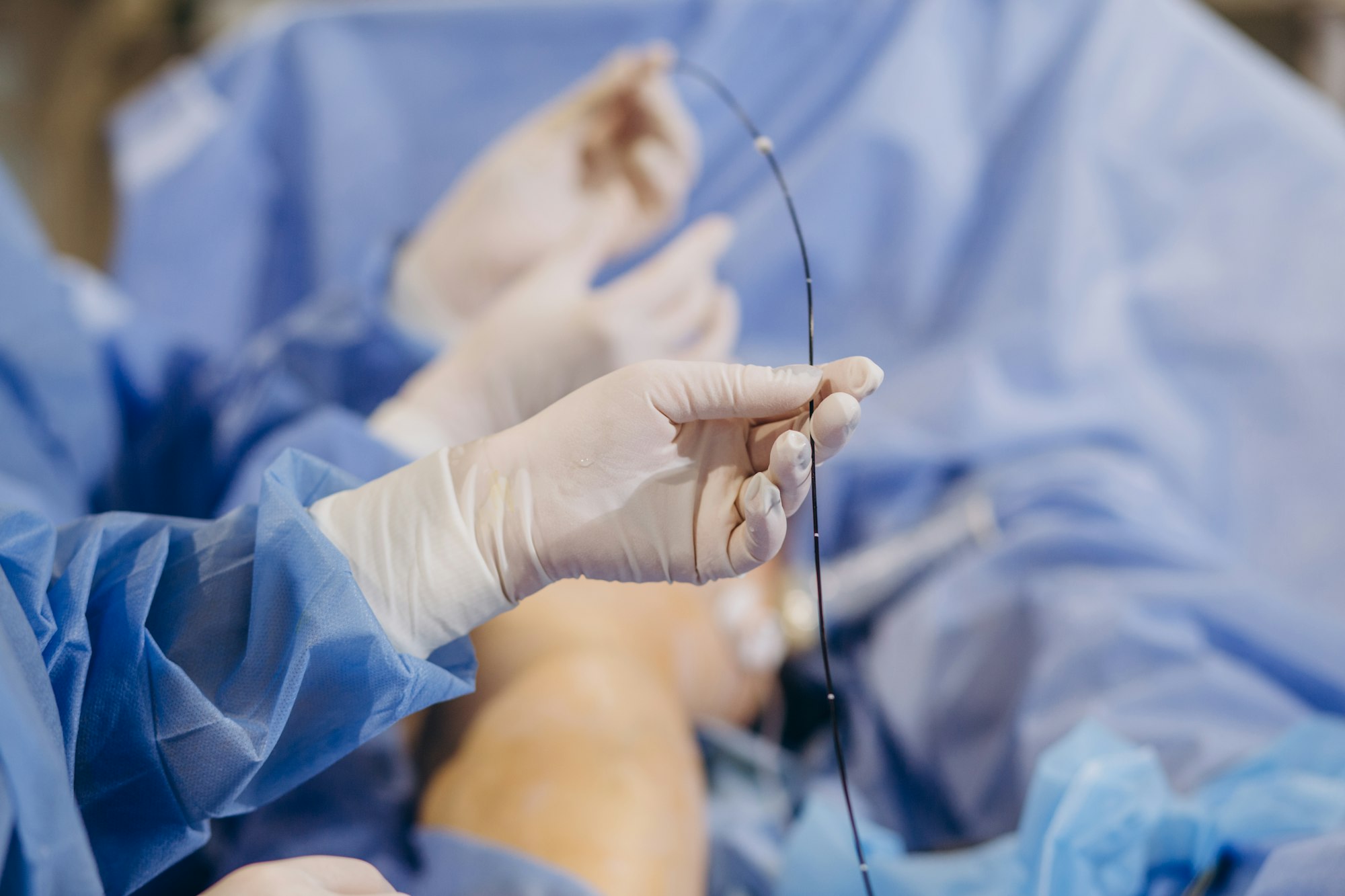Doctor surgery foot Suture,Percutaneous transluminal angioplasty ,Vascular bypass blood vessel g